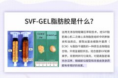 svf脂肪胶填充是什么，好不好？带你认识填充新秀！