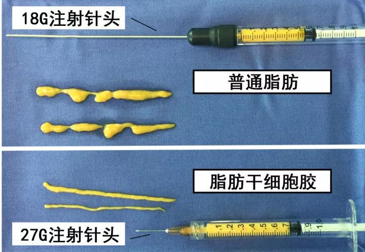 svf脂肪胶填充的优点