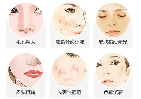 黑脸娃娃的费用是多少