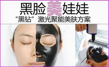 黑脸娃娃的费用是多少