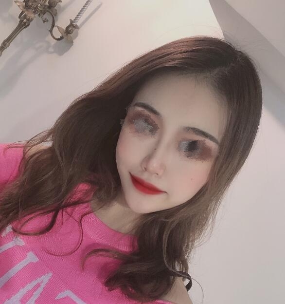 深圳江南春天医疗美容隆鼻案例分享