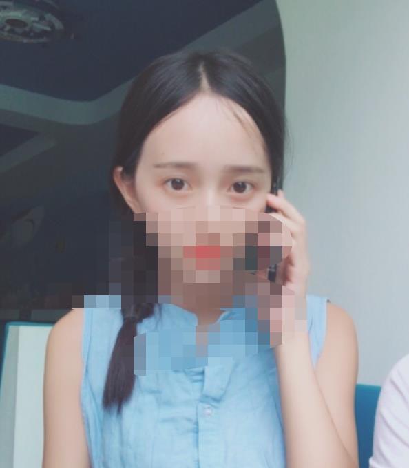 北京八大处赵延勇医生做双眼皮怎么样?