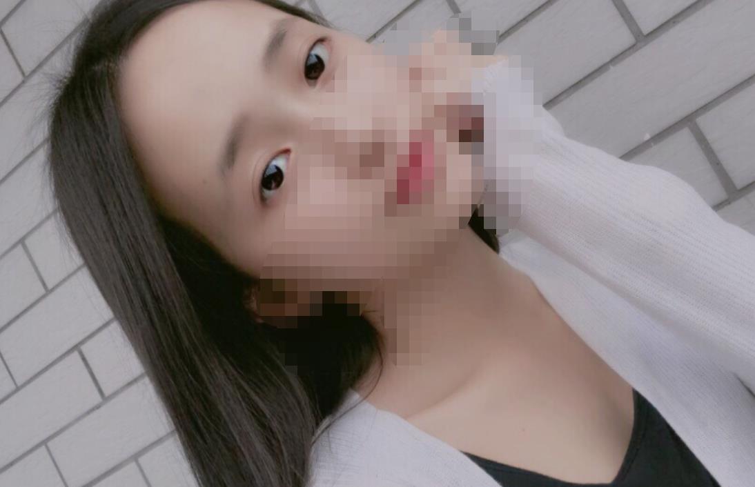 北京八大处赵延勇医生做双眼皮怎么样?