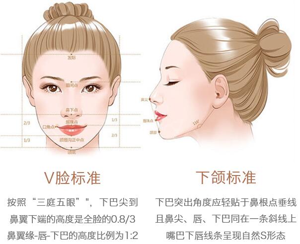 自体脂肪隆下巴