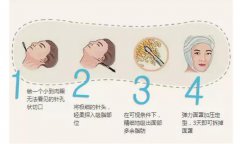 面颊吸脂是吸哪里？价格是多少？不听话的肉肉这样处理，魅力加分！