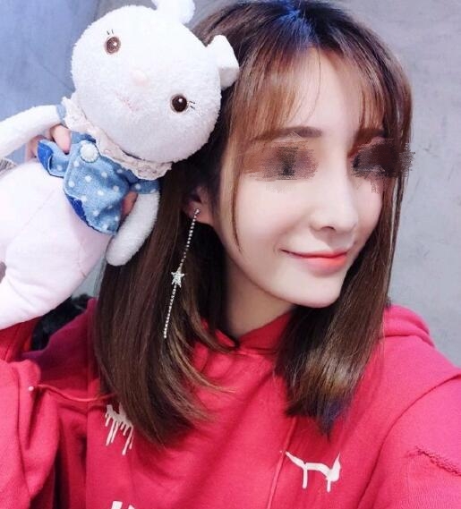 做歪鼻矫正果图分享