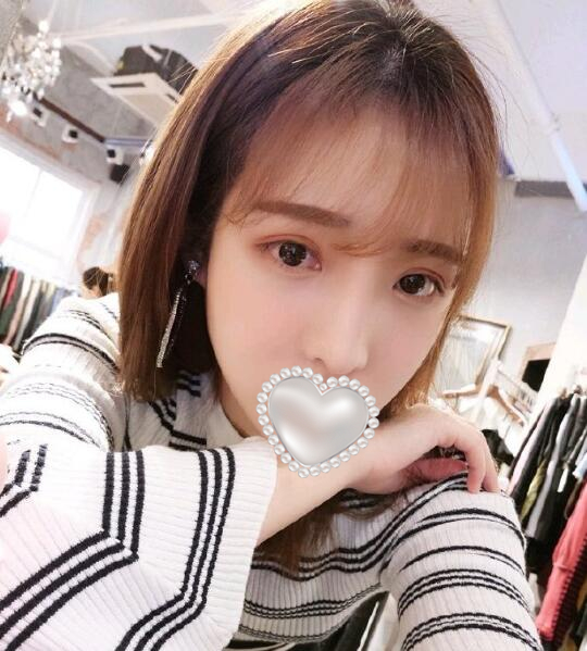 做歪鼻矫正果图分享