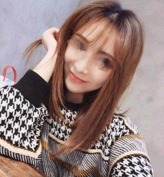 做歪鼻矫正果图分享