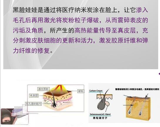 黑脸娃娃和光子嫩肤哪个果好