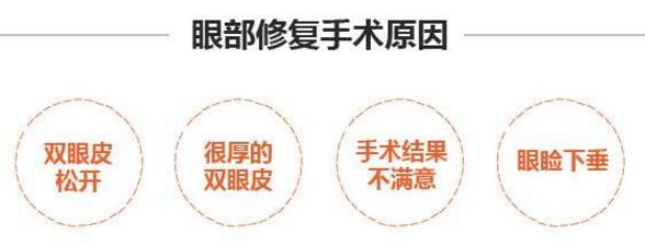 卢建建医生科普双眼皮修复手术