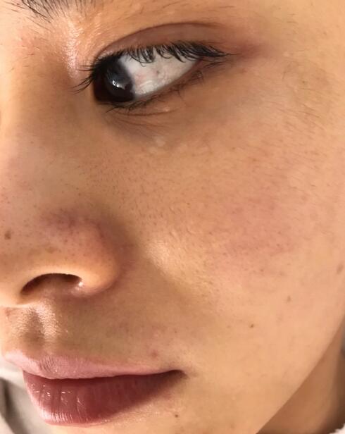 去黑头黑脸娃娃果图对比