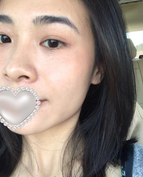 去黑头黑脸娃娃果图对比