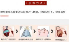 硅胶隆鼻的副作用大吗？科普解答你害怕的是什么！
