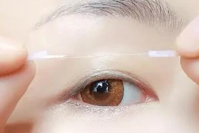 单眼皮如何变双眼皮