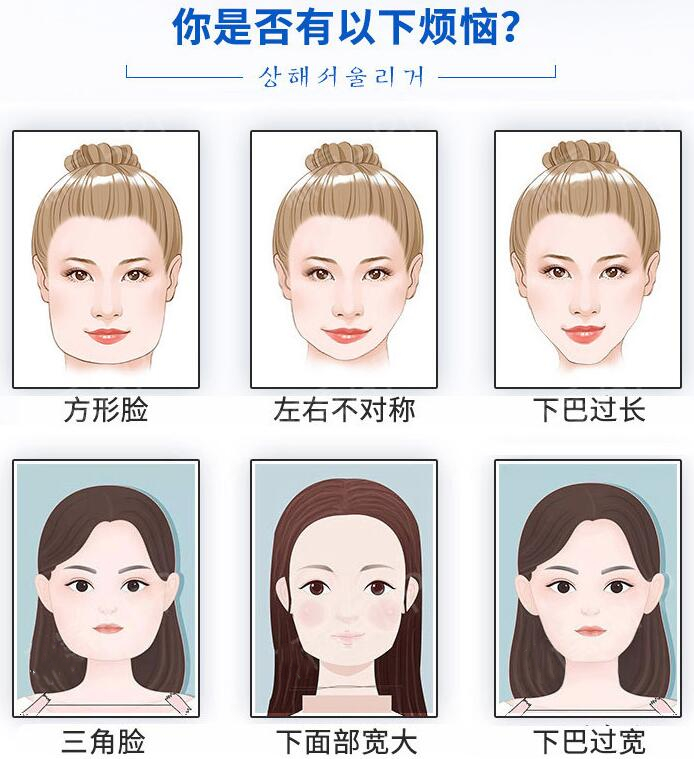 整瓜子脸需要多少钱