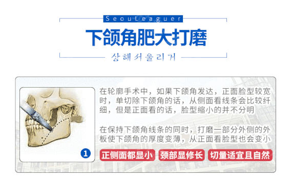 整瓜子脸手术方法