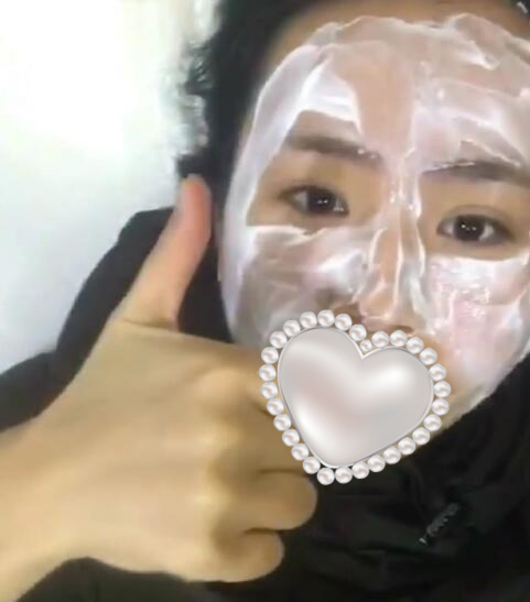 上海光博士齐显龙医生祛痘案例分享