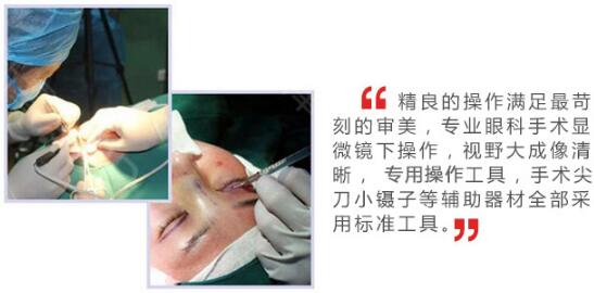 石家庄雅芳亚医院科普双眼皮整形