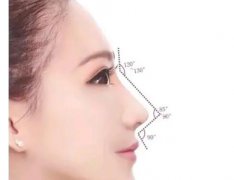 鼻翼整形费用大约是多少？影响价格的因素有哪些？