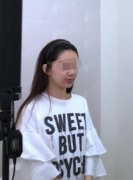 嘟嘟唇打完5天内的图片分享！来看术后果怎么样吧
