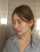 埋线提升一到7天恢复图来袭！快来看看整容前后差别大不大吧！