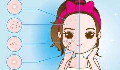 激光祛斑祛痘怎么样？真实的果可靠吗？原理是什么？