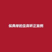 侯典举的歪鼻矫正技术怎么样？实力值得信赖吗？进来了解一下吧！
