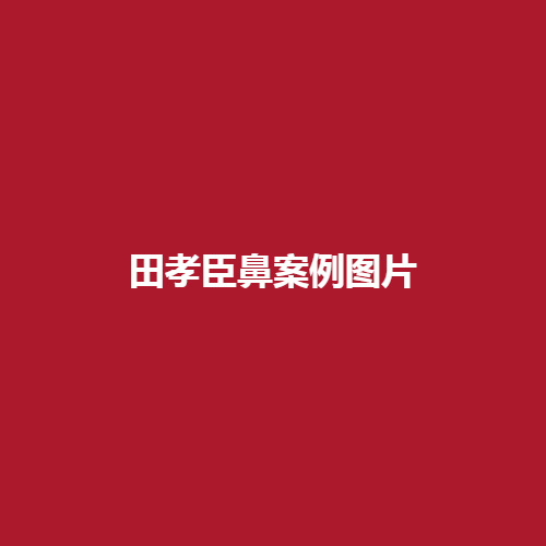 田孝臣比案例图片真实吗?在隆鼻领域里的技术可靠吗?案例分享了解一下吧。