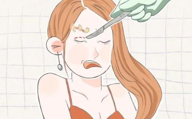 双眼皮是割还是埋线？那种果保持的时间久一些？术后注意事项分享