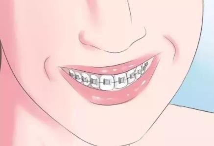 牙齿矫正动漫h5.jpg 牙齿矫正动漫h5.jpg