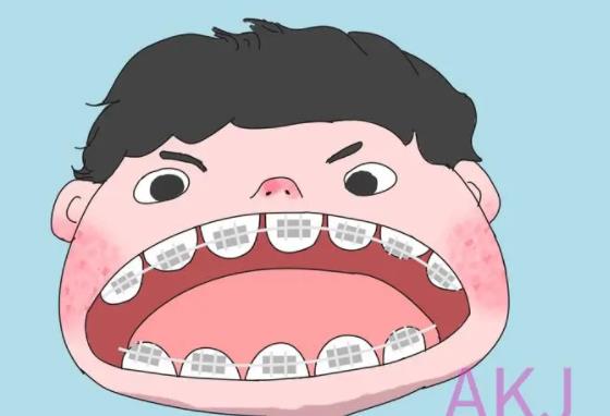 牙齿矫正dm01.jpg 牙齿矫正dm01.jpg