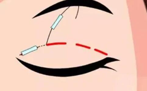 双眼皮动漫64.jpg 双眼皮动漫64.jpg