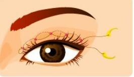 双眼皮动漫23.jpg 双眼皮动漫23.jpg