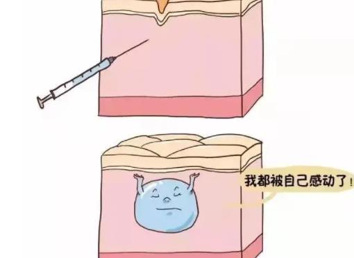 玻尿酸dm07.jpg 玻尿酸dm07.jpg