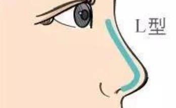 隆鼻卡通h03.jpg 隆鼻卡通h03.jpg