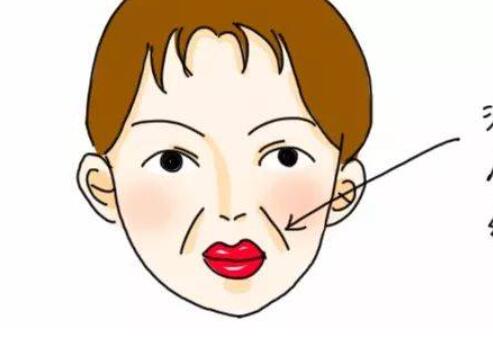 法令纹动漫03.jpg 法令纹动漫03.jpg