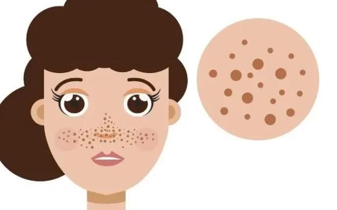 祛斑动漫02.jpg 祛斑动漫02.jpg