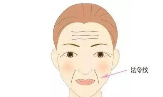 法令纹动漫02.jpg 法令纹动漫02.jpg