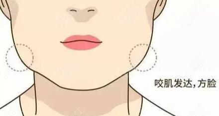 咬肌发达动漫01.jpg