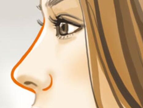 隆鼻动漫02.jpg 隆鼻动漫02.jpg