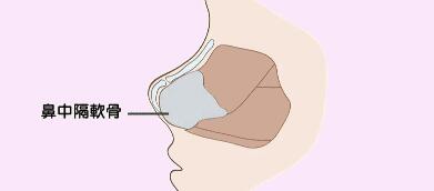 隆鼻动漫25.jpg 隆鼻动漫25.jpg