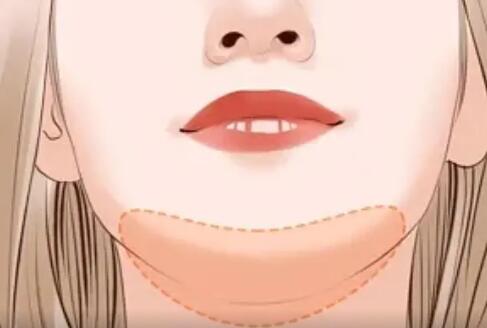 丰下巴动漫14.jpg 丰下巴动漫14.jpg