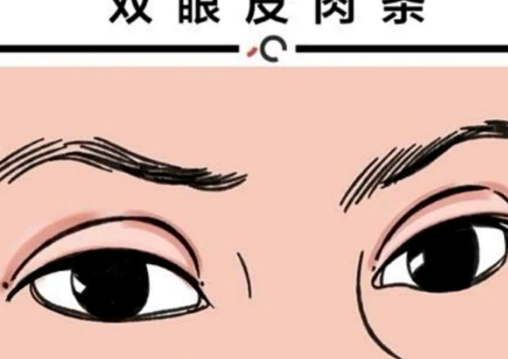济南中心医院双眼皮李洋，实力派医生分享案例！真实果图公布！