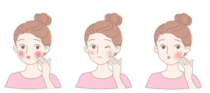 果酸换肤动漫01.jpg 果酸换肤动漫01.jpg