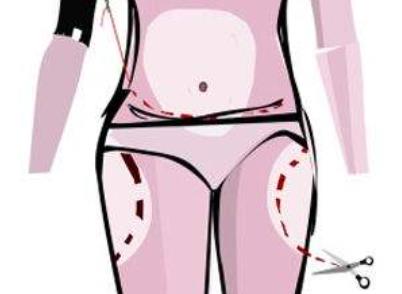 吸脂dm023.jpg 吸脂dm023.jpg