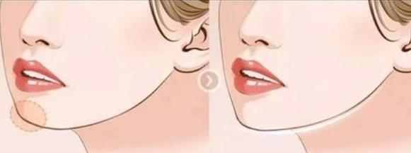 下巴动漫03.jpg 下巴动漫03.jpg