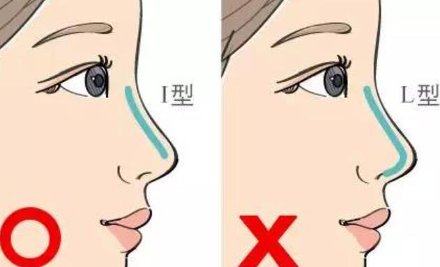 隆鼻动漫h17.jpg 隆鼻动漫h17.jpg