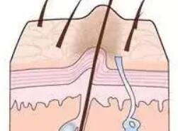 祛疤动漫15.jpg 祛疤动漫15.jpg