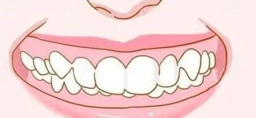 牙齿矫正动漫09.jpg 牙齿矫正动漫09.jpg