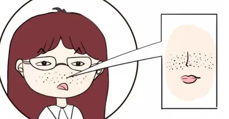 皮肤干燥粗糙怎么办.jpg 皮肤干燥粗糙怎么办.jpg